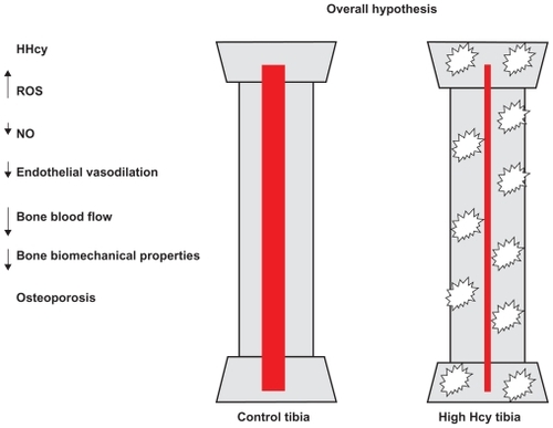 Figure 4 The hypothesis was that high levels of Hcy lead to increased ROS, decreased NO bioavailability and other factors, decreased endothelial vasodilation, and decreased bone blood flow, which could lead to decreased biomechanical properties. The hypothesis was that high levels of Hcy lead to increased vascular resistance from decreased vasodilation, which could lead to decreased biomechanical properties, including decreased BD.