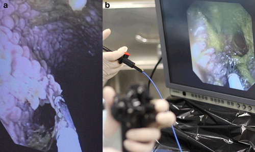 Figure 1. Photographs of (a) guided biopsy of papillae in the anterio-ventral region of the rumen of a sheep using oral endoscopy, and (b) the endoscopy procedure showing the hand held steering mechanism for the endoscope in the foreground, the hand piece to operate the biopsy forceps above this and the monitor showing the rumen with the papillae in the background.