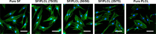 Figure S2 F-Actin of hADSCs seeded on SF/PLCL nanofibrous scaffolds of different weight ratios. Scale bars: 20 μm.Abbreviations: hADSCs, human adipose-derived stem cells; PLCL, poly(lactide-co-ε-caprolactone); SF, silk fibroin.