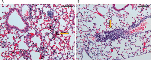 Figure 6. Histological changes in lung tissue 90 days post-exposure at 20× magnification. (A) Tissue from mouse exposed to a total carbon black surface area of 540 cm2 (corresponding to instilled mass dose of 54 ug) XE2B, (B) tissue from mouse exposed to 39 cm2 (corresponding to 162 ug) FL101. Alveolar walls in A appear widened due to capillary congestion, probably related to the euthanasia.
