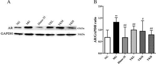 Figure 5. Effect of YK on AR protein expression in ovaries of PCOS rats. (A) The expression of AR in the ovaries was detected by Western blot. (B) Statistical analysis of AR expression by imageJ. Data are shown as mean ± SD. Compared with the NG group, *p < .05, **p < .01, compared with the MG group, #p < .05, ##p < .01.