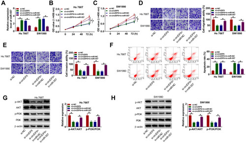 Figure 4 CircEIF6 knockdown restrains the malignant phenotypes of pancreatic cancer cells through enhancing miR-557 level. (A–H) Hs 766T and SW1990 cells were transfected with si-EIF6 alone or together with in-miR-557. (A) Evaluation of miR-557 abundance in transfected pancreatic cancer cells was conducted via qRT-PCR. (B and C) The influences of circEIF6 silencing and miR-557 silencing on the proliferation of pancreatic cancer cells were analyzed by CCK8 assay. (D and E) Transwell assays were implemented to analyze cell migration and invasion abilities in transfected pancreatic cancer cells. (F) Flow cytometry was conducted to count the percentage of apoptotic pancreatic cancer cells (the first quadrant and the fourth quadrant). (G and H) Western blot assay was conducted to detect the abundance of p-AKT, AKT, p-PI3K and PI3K in transfected pancreatic cancer cells. *P<0.05.