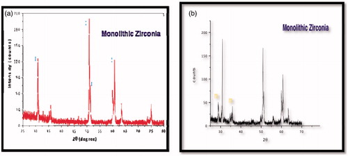 Figure 1. X-ray diffraction patterns of monolithic zirconia: (a) before aging, (b) after aging with monoclinic (m) peaks.
