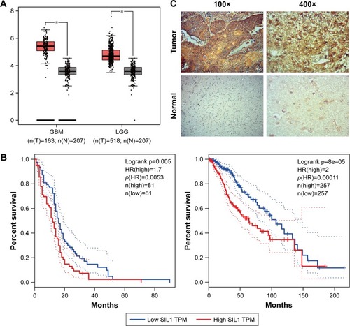 Figure 1 SIL1 was highly expressed in glioma and represented a poor prognosis. (A) The red and gray boxes represent glioma and normal tissues, respectively. The y-axis indicates the log2-transformed gene expression level. (B) Survival percentage of glioma patients with high or low SIL1 expression. Left: GBM; right: LGG. The data of (A) and (B) were obtained with permission from,Tang Z, et al. (2017) GEPIA: a web server for cancer and normal gene expression profiling and interactive analyses. Nucleic Acids Res. 10.1093/nar/gkx247.Citation15 (C) Endogenous levels of SIL1 in glioma and paracarcinoma tissues were tested by immunohistochemical assay.