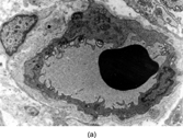 Fig. 10 Pericyte (a) adjacent to blood capillary vessel and (b) enclosed within layers of external lamina, showing pinocytosis, Golgi complex, and abundant cytoplasmic filaments, focally with dense bodies suggesting myoid differentiation.