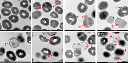 Figure 3 Transmission electron micrographs of untreated MRSA (A) and MRSA treated with menthone at 0.1× MIC (B), 0.5× MIC (C-D), and 1× MIC (E-H). The arrows mark areas of membrane damage and cell content release. 1. numerous spherical mesosome-like structures; 2. lack of cytoplasm; 3. separation of cytoplasmic membrane from the cell wall; 4. cell deformation; 5. leakage of cytoplasmic content; 6. cellular debris from lysed cells.