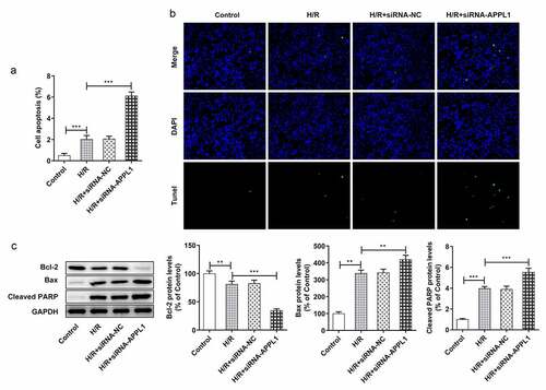 Figure 5. APPL1 knockdown aggravated hypoxia/reperfusion-induced apoptosis in H9C2 cells. (a-b) The H9C2 cell apoptosis was analyzed by TUNEL assay and quantification. (c) The expression levels of Bcl-2, Bax, cleaved PARP were determined by western blotting. Error bars represent the mean ± SEM from three independent experiments. **P < 0.01, ***P < 0.001