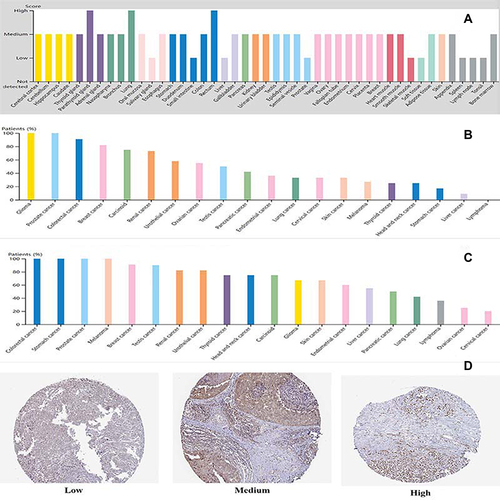 Figure 2 HuR protein expression overview in human normal and tumor tissues (data from The Human Protein Atlas; Creative Commons). (A) HuR protein expression overview in human normal tissues. (B) HuR protein nuclear expression overview in human tumor tissues. (C) HuR protein cytoplasmic expression overview in human tumor tissues. (D) Representative IHC images of cytoplasmic HuR expression levels in breast cancer tissues.