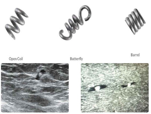 Figure 1. HydroMARK biopsy clip in their native forms (a) and after clip deployment (b)