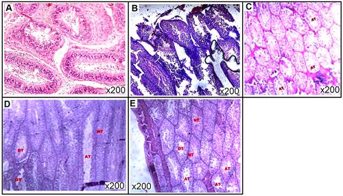 Figure 7 Representative photomicrographs of histological assessment of testes of Sprague-Dawley rats after 60 days of treatment. (A) Normal saline–treated rats showing well-layered seminiferous tubules with different stages of spermatogenic cells; (B) 50 mg/kg monosodium glutamate (MSG)-treated rats showing severe atrophy in some seminiferous tubules and reduction in interstitial Leydig cells; (C) 1,000 mg/kg SJRE–treated rats showing mild atrophy of seminiferous tubules; (D) 1,000 mg/kg CBRE–treated rats showing severe atrophy in some seminiferous tubules; (E) 1,000 mg/kg PPRE–treated rats showing different degrees of atrophy (transverse section, 200×, H&E stain).