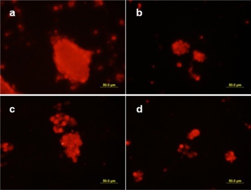 Figure 1 Nestin expression in neural stem cells. Neural stem cells were plated and their stemness assessed using an antibody raised against the stem cell marker, nestin. a) and b) Three-month-old neural stem cells; c) and d) 20-month-old neural stem cells; a) and b) male neural stem cells; c) and d) female neural stem cells.