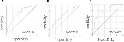 Figure 2 Receiver operating characteristic curves for discriminating patients with low PCI (<15) and high PCI (≥15). (A) neutrophil–lymphocyte ratio, (B) platelet–lymphocyte ratio, (C) D-dimer.