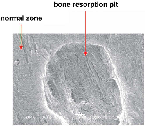 Figure 1.  A scanning electron micrograph of bone slice.