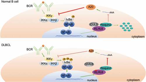 Figure 2. Model of KLHL6-Roquin2 axis in ABC-DLBCL. In physiologic B-cell receptor signaling (upper panel), KLHL6 is up-regulated upon antigen-induced BCR/NF-κB activation. High levels of KLHL6 induce proteasomal degradation of Roquin2, resulting in A20 accumulation due to low mRNA decay. A20 negatively regulates BCR signaling by inhibiting the IKK complex. In DLBCLs harboring KLHL6 mutations (lower panel), Roquin2 degradation is impaired, resulting in higher A20 mRNA decay and constitutive activation of IKK.