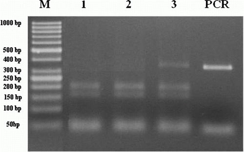 Figure 1.  Gel electrophoresis of PCR products after digested with TaqI restriction enzyme for BLAD gene polymorphism. M: 50 bp DNA ladder (Fermantase-SM0613). Line 1–2: homozygous normal animals showing two bands (191, 152 bp). Line 3: heterozygous carrier animals showing three bands (343, 191, 152 bp). PCR products of BLAD (343 bp).