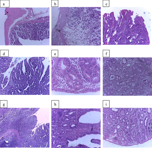 Figure 3 Photomicrographs showing hematoxylin and eosin stained normal colon and tumor pathological sections taken from Normal Control, DMH20, PIV100, PIV200, PIV400, POV100, POV200, POV400, and A+SA60 groups respectively; colon with normal glands having normal mucosal and sub-mucosal layers (a), invasive adenocarcinoma (b), tubulovillous adenoma (c), villous adenoma (d), tubular adenoma (e), invasive carcinoma (f), villous adenoma with villous components (g), tubular adenoma (h), Tubular adenoma with increased number of glands (i).