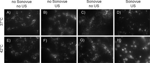 Figure 3. Epifluorescence imaging of two-step delivery. Only the combination of two consecutive steps – heating and sonication in presence of Sonovue microbubbles lead to the model drug TO-PRO-3 release from the thermosensitive liposomes and its intracellular uptake (visible as nuclear staining, H, exposure time 100 ms). Under other conditions the dye either remained encapsulated in the liposomes (A-D, exposure time 500 ms) or was not able to enter the cytoplasm and diffuse to the nucleus (E-G, exposure time 500 ms). (From Yudina et al, J Contr Release 2011).