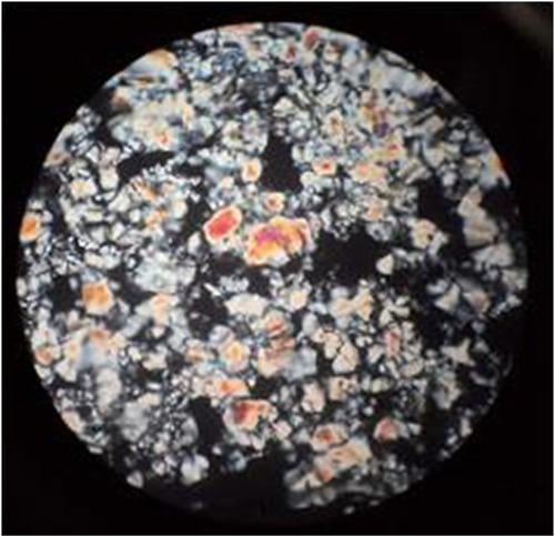 Figure 3 Polarized light microscopy photomicrographs of Tr-loaded LCG (FC) (magnification ×100).Abbreviations: FC, 38.46% lecithin, 46.16% capryol, and 15.38% water; LCG, liquid crystalline nanogel; Tr, terconazole.