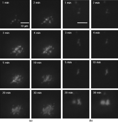 Figure 4.  Time-series of TIRF images during the adhesion process: (a) normal cell; (b) virus-infected cell.