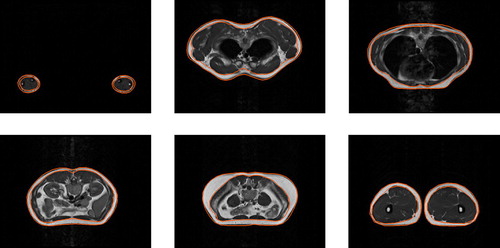 Figure 2. The axial slices of the segmented geometries of the subcutaneous fat layer from MRI data-set of BMI 23 using the proposed model.