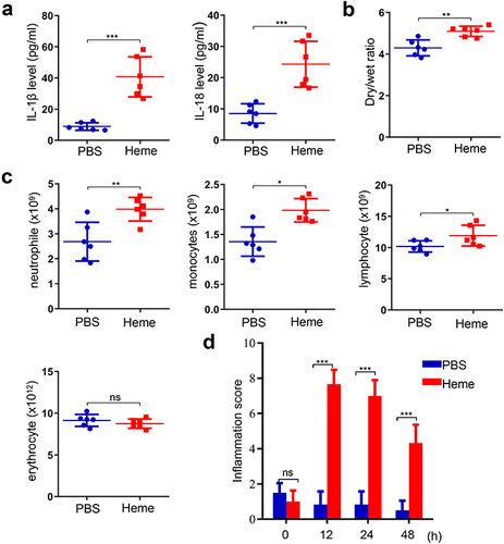 Figure 2 Heme induces SIRS in mice. (a) The levels of IL-1β and IL-18 were detected after heme treatment. (b) The wet-to-dry lung ratio was calculated after heme treatment. (c) The neutrophil, monocyte, erythrocyte, and lymphocyte count were detected. (d) The inflammation score of mice was measured at 0 h, 12 h, 24 h, and 48 h after heme treatment. There were 6 mice in each group. The data are expressed as mean ± SEM. ns: no significance, *P < 0.05, **P < 0.01, ***P < 0.001.