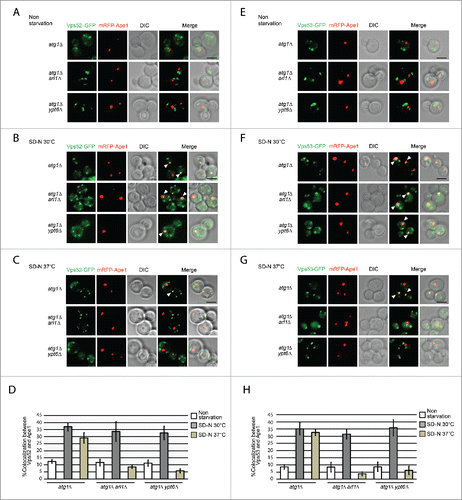 Figure 8. Arl1 and Ypt6 are required for GARP subunits Vps52 and Vps53 to be translocated to the PAS. ((A)– C) Fluorescence images of the yeast strains atg1Δ (YSA015), atg1Δ arl1Δ (YSA016) and atg1Δ ypt6Δ (YSA017) under nonstarvation conditions, starvation at 30°C and starvation at 37°C. Arrows point to the colocalization between Vps52-GFP and mRFP-Ape1. (D) The percentage of cells with colocalization between Vps52-GFP and mRFP-Ape1. At least 90 cells were counted for each strain at each condition. Error bars represent standard deviation from 3 biological replicates. ((E)– G) Fluorescence images of the yeast strain atg1Δ (YSA018), atg1Δ arl1Δ (YSA019) and atg1Δ ypt6Δ (YSA020) under nonstarvation conditions, starvation at 30°C and starvation at 37°C. Arrows point to the colocalization between Vps53-GFP and mRFP-Ape1. (H) The percentage of cells with colocalization between Vps53-GFP and mRFP-Ape1. At least 90 cells were counted for each strain under each condition. Error bars represent standard deviation from 3 biological replicates. Scale bar: 3 µm.