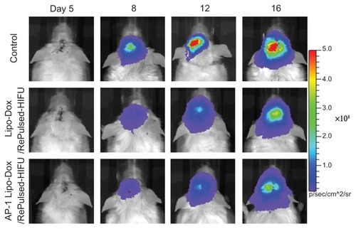 Figure 5 Longitudinal bioluminescence imaging of the brain tumors was monitored from 5 to 16 days after implantation. Firefly luciferase-labeled GBM8401 cells had been implanted into the left forebrain of NOD-scid mice which received no treatment (control), post-treatment with repeated pulsed HIFU after liposomal doxorubicin on day 5, or post-treatment with repeated pulsed HIFU after AP-1 liposomal doxorubicin injection on day 5.Abbreviations: AP-1, atherosclerotic plaque-specific peptide-1; Lipo-Dox, liposomal doxorubicin; HIFU, high-intensity focused ultrasound.