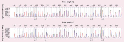 Figure 3. Peak profile of multiplex ligation-dependent probe analysis.Each peak represents a specific probe amplification product. The first chromatogram represents whole-gene deletion (blue peak) while the bottom chromatogram represents the duplication of exon 1–6 and normal copy number of exon 9 compared with the normal control group (red peak). Note how the blue peak is 0.5-times higher and shorter for 1-copy duplication and deletion, respectively.ex: Exon; nt: Nucleotide; RFU: Relative fluorecent unit.