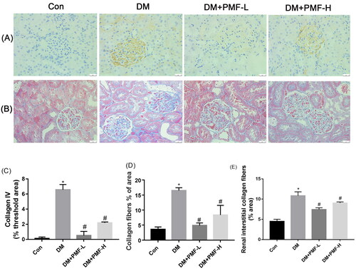Figure 6. Effects of PMF on the accumulation and expression of collagen fibers in the kidney of diabetic rats. (A) The expression of collagen IV in the kidney of rats was detected by IHC. (B) The accumulation of collagen fibers in the kidney of rats was tested by Masson staining. (C) The quantification of collagen IV tested by IHC was statistically analyzed. (D) The quantification of collagen fibers (blue) accumulated in the kidney was statistically analyzed. (E) The renal interstitial collagen fibers were calculated by Image J software. Original magnification, ×400. *p < 0.05 vs. control, #p < 0.05 vs. Con: nondiabetic rats without treatment; DM: diabetic rats treated with saline; DM + PMF-L: diabetic rats treated with 5 mg/kg PMF; DM + PMF-H: diabetic rats treated with 25 mg/kg PMF.