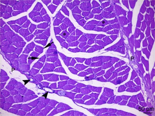 Figure 5 The cross-sectional faces of striated skeletal muscle fibers are observed in a multi-sided appearance in the micrograph of the control group. Peripheral nuclei (arrow) under the sarcolemma of muscle fibers, cross sections of myofibrils (asterisk) in the cytoplasm are observed and in the perimysium (P) surrounding the fascicles formed by muscle fibers, blood vessels (arrowheads) draw attention. H&E ×200.
