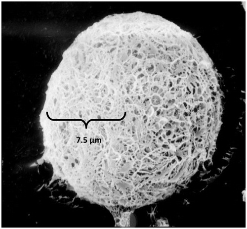 Figure 2. Transmission electron microscope photograph of SM-loaded PLGA microspheres. × 5000.