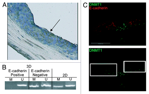 Figure 6. Gain of E-cadherin expression in the Inv-1a tissues is due to loss of DNA methylation, increased stromal invasion and elevated DNMT1 expression. (A) E-cadherin staining in a paraffin section of Inv-1a tissue used for LCM. The black arrow indicates the E-cadherin positive cells that were removed for DNA isolation. (B) MSP analysis of the DNA isolated from microdissected E-cadherin negative and positive cells in the Inv-1a tissue. Inv-1a cells grown in 2D culture were used as a control. (C) Immunohistochemical staining of E-cadherin (red) and DNMT1 (green) in 3D tissues composed of Inv-1a cell. The white boxes indicate regions of the tissue that stain for E-cadherin but have low levels of DNMT1 expression. Scale bars = 100 µm.