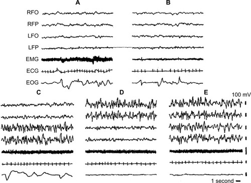 Figure 2 Electrographic recordings of the Cape fur seal.