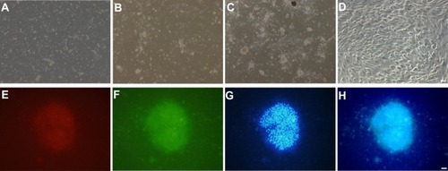 Figure 2 Isolation, cultivation, and identification of pericytes from cerebral microvessels. (A) Isolated microvessels were cultured in the pericyte medium. (B) Pericytes crawled out from the microvessels on Day 3. (C) Pericytes crawled out from the microvessels on Day 7. (D) Pericytes crawled out from the microvessels on Day 14; (E–H) co-expression of PDGFRβ and NG2, as determined by immunofluorescence, identified the isolated cells as pericytes. (E) PDGFRβ-stained pericytes. (F) NG2-stained pericytes. (G) Dapi-stained nucleus. (H) Merged.
