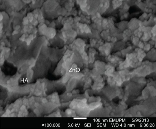 Figure 2 FESEM image of the HA/ZnO nanocomposite.