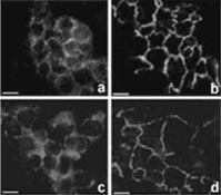 7 Immunostaining of occludin (a, b) and ZO-1 (c, d) in HepG2 cells after 12 days of culture in the absence (a, c) or presence (b, d) of RA. After long-term RA treatment occludin and ZO-1 are both localized in the cell membrane and the scattered cytoplasmic staining of controls disappears. There was no labeling when the first antibody was omitted (not shown). Bars = 10 μm. (See Color Plate IV).