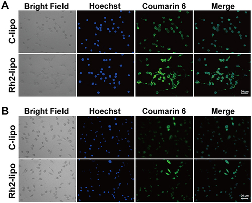 Figure 2 The confocal fluorescence images of cellular uptake on L929 cells (A) and 4T1 cells (B). Scale bar = 20 μm.