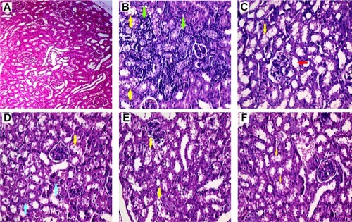 Figure 4 Renal histopathological alterations in the lead (Pb)-exposed mice.