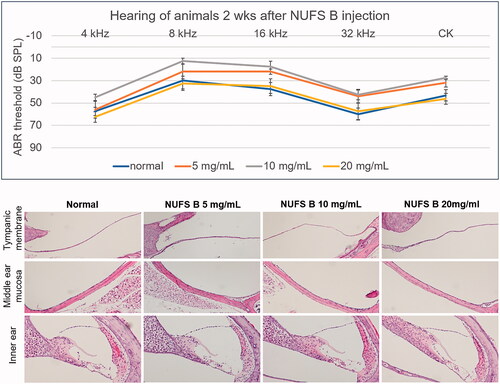 Figure 8. In vivo safety assessment after intratympanic injection of a dexamethasone nanosuspension (NUFS B). NUFS B was injected into the middle ear at concentrations of 5, 10, and 20 mg/mL. Two weeks after drug injection, the animals' hearing was evaluated by measuring the ABR, and histological evaluation was performed after the hearing examination. (A) As indicated by the ABR results, animals treated with NUFS B at up to 20 mg/mL showed no hearing loss compared to the normal group. (B) Histological evaluation showed no inflammatory reaction in the tympanic membrane or the middle ear mucosa in any of the NUFS B animals, and no damage was observed in the inner ear tissue.