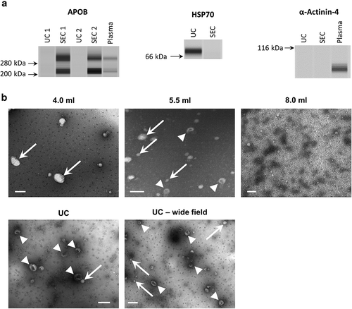Figure 5. Western blotting and electron microscopy of rat blood plasma samples obtained with SEC or UC.(a): Wes™ Simple Western (ProteinSimple; see Methods for details) for APOB (left), HSP70 (right, top), alpha-Actinin-4 (right bottom) of UC and pooled SEC (3.5–6.0 ml) samples. (b): TEM images of SEC fractions 4.0, 5.5 and 8.0 ml (top panels) and UC-sEVs (bottom panels). Arrows indicate lipoprotein-resembling structures. Arrowheads indicate sEVs. Scale bar: 200 nm.