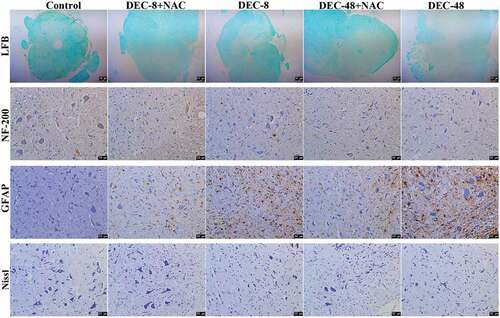 Figure 2. NAC treatment for 2 months alleviates nerve damage in rats with SCI after decompression surgery. Histological analysis of injured spinal cords by LFB, NF-200, GFAP, and Nissl staining. Scale bar = 50 μm.