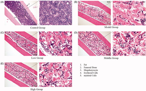 Figure 4. Histopathological observations of femoral bone marrow. (A) Femoral bone marrow of the control group; (B) Femoral bone marrow of the model group; (C) Femoral bone marrow of the low-dose group; (D) Femoral bone marrow of the middle dose group; (E) Femoral bone marrow of the high-dose group.