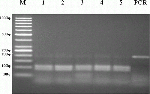 Figure 2.  Gel electrophoresis of PCR products after digested with AvaII restriction enzyme for BC gene polymorphism. M: 50 bp DNA ladder (Fermantase-SM0613). Line 1–5: homozygous normal animals showing two bands (103, 82 bp). PCR products of BC (185 bp).