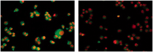 Figure 2. EGFR (left panel; green color) of MDA-MB-231 breast cell line and (right panel) MDA-MB-231 breast cell line after treatment with compound 31.