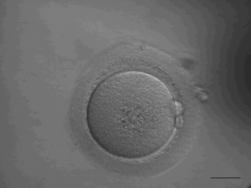 Figure 1.  Human oocyte with 2 polar bodies extruded into perivitelline space, observed at 4 hours after oocyte-sperm coincubation. Scale bar indicates 40 µm.