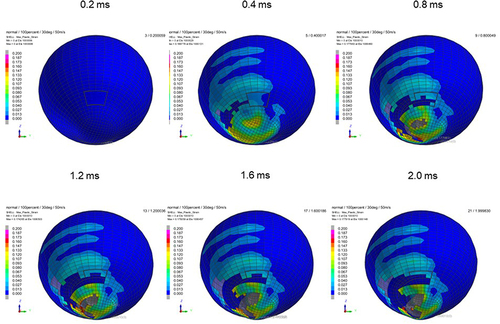 Figure 4 Sequential strain strength response of ocular surface of model eye upon airbag impact in 30°-gaze down position at 50 m/s with adhesion strength of scleral flap of 100%, shown at 0.4-ms intervals after 0.2 ms. Strain strength change is displayed in color as presented in the color bar scale (Figure 2).