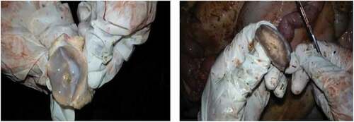 Figure 2. BTB suggestive gross lesions on retropharyngeal (left) and mediastinal (right) lymph nodes among slaughtered cattle