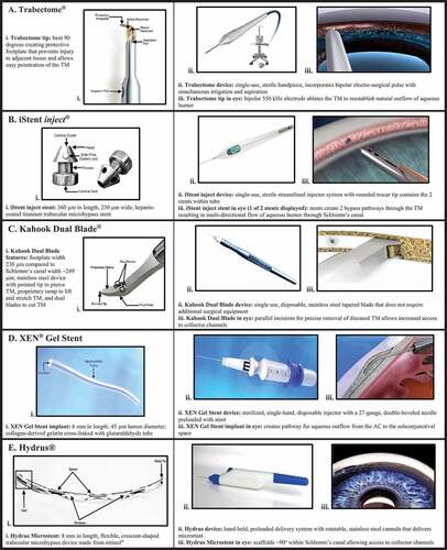 Figure 1. Summary of the different types of MIGS. A. Trabectome. B. iStent inject. C. Kahook Dual Blade. D. XEN Gel Stent. E. Hydrus