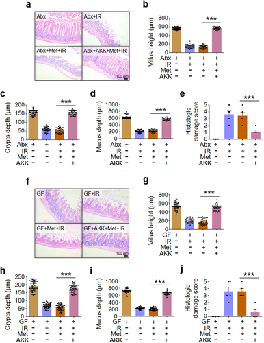 Figure 6. A. muciniphila is necessary and sufficient for metformin-induced radioprotection in intestine.