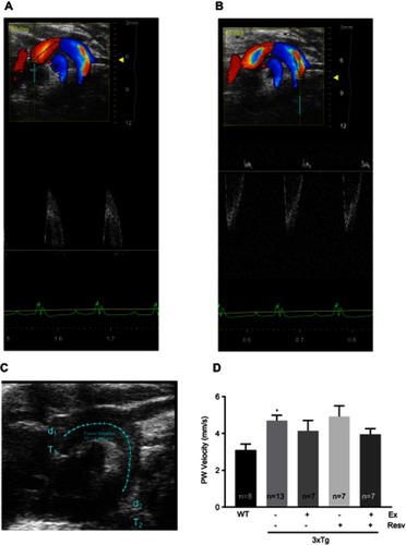 Figure 2 Measurements of aortic wall stiffness by echocardiography. Aortic PWV was measured as an indirect index for aortic wall stiffness. Representative images of the pulse wave Doppler-mode aortic arch view in a 7-month-old WT mouse highlighting ascending (A) and descending (B) aortic Doppler waveforms and aortic arch distance between two-sample volume positions (C). Values for PWV were significantly increased in 3xTg mice when compared to the WT group, indicating increased aortic wall stiffness. None of the treatment protocols normalized PWV in 3xTg mice (D). Values are reported as mean±SEM for 7–13 mice in each group. * vs WT control, P<0.05.Abbreviations: PWV, pulse wave velocity; WT, wild-type.